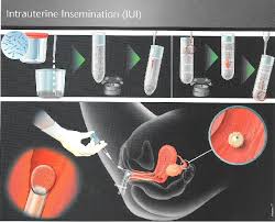 For this reason, the cost is usually available on request from each specific breeder. Iui Cost In India Affordable Iui Treatment Cost In Surat