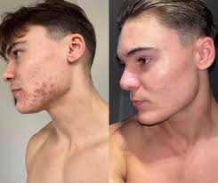 Sarah McKibbin Dermal