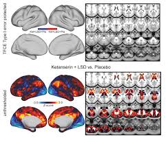 The amount taken, along with the user's mood, personality and surroundings lsd users can develop a tolerance necessitating higher does over time to achieve the same high. Changes In Global And Thalamic Brain Connectivity In Lsd Induced Altered States Of Consciousness Are Attributable To The 5 Ht2a Receptor Elife