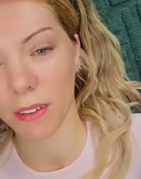 ✨ Hyaluron Needle-Free Lip Fillers ✨, Dreamy, hydrated lips — no needles,  no pain 💋💉🚫, Instant volume & deep hydration for naturally beautiful  lips 😍, 💄 30 units