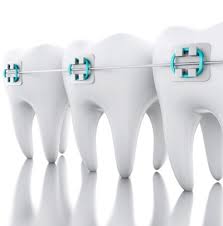 Knowing how to handle one it is not uncommon for archwires and ligatures to sometimes poke into your lips and gums, but there are home solutions to help you when a trip to our. Broken Braces What To Do If A Bracket Or Wire Breaks Don T Panic