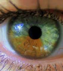 Harika kahverengi gözler, aynı anneninkiler gibi. Un Medecin Parvient A Changer Des Yeux Marrons En Yeux Bleus Avec Un Laser
