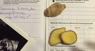 Schwanger Mit Mehr Als Ein Bisschen Ubelkeit Von Guten Eltern