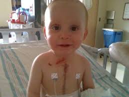 Kalunu ni World Prematurity Day, avana kwivulwa nivataaduka ing'inga yaavo  yukwivulwa. Sigisa iliteva kinga inganagani ku umugeni. #VuukaVuchee