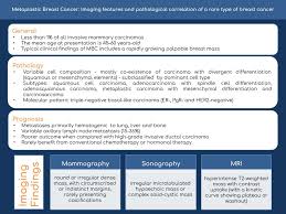 The classic description of a breast cancer is a mass with an irregular shape and spiculated margin (fig. Epos C 13450