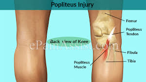 Unlocks knee joint (laterally rotates femur on fixed tibia). Popliteus Injury Symptoms Treatment Sports Massage Nsaids Knee Braces