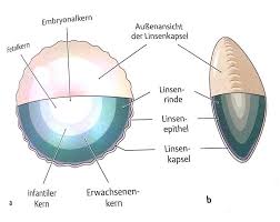 In latin, cataracta had the alternative meaning portcullis79 and the name possibly passed through french to form the english meaning eye disease (early 15th century), on the notion of obstruction. Https Opendata Uni Halle De Bitstream 1981185920 12310 1 Dissertation Julia Anette B C3 B6pple Pdf