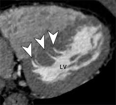 Echocardiography - Wikipedia