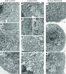 Maybe you would like to learn more about one of these? Ultrastructural Analysis Of B Cells By Transmission Electron Microscopy Download Scientific Diagram