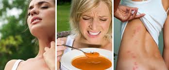 Lapač hmyzu na leto bez múch a komárov