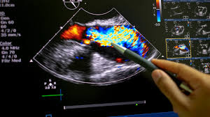 Ultrasounds performed by a licensed medical professional (physician or sonographer) can cost anywhere between $100 and $1000.2 мая 2014 г. When Does Medicare Pay For Echocardiograms Cover Rules And Costs