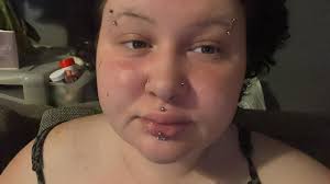 Professional field gauges healing concerns