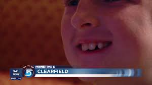 Clearfield boy missing most of his teeth endures relentless teasing