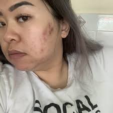 SKIN RESOLUTIONS BY REGINA