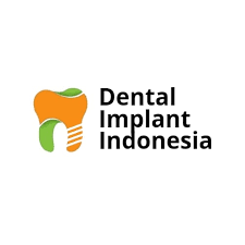 Logo Dental Implant Indonesia