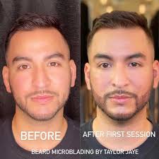 *keep alcohol intake to a minimum 2 days prior to and after your procedure. Men S Microblading Beard And Mustache