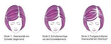 Haarausfall Frauen Infos Hilfe Regaine