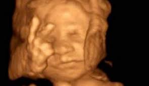 We did not find results for: The Benefits Of 3d 4d Ultrasound 1st Glimpse Inc 3d 4d Ultrasound