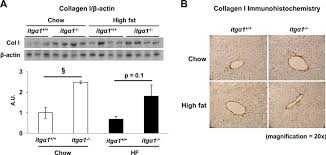 integrin a1 null mice exhibit improved fatty liver when fed a high fat diet despite severe hepatic insulin resistance journal of biological chemistry