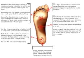 Identify Foot Pain Podiapro Custom Orthotic Insoles