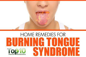 How To Treat Burning Tongue Syndrome Burning Tongue Burning Tongue Syndrome Burning Mouth Syndrome