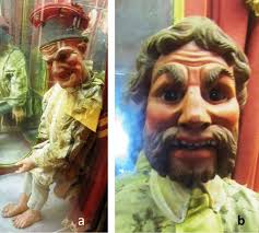 Acromegaly features in performing Marionette