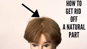After my operation, all my hair fell out. How To Get Rid Of A Natural Hair Parting Thesalonguy Youtube