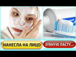как избавиться от прыщей на лице с помощью зубной пасты Nanesla Na Lico I Ruki Zubnuyu Pastu I Udivilas Rezultatu Youtube