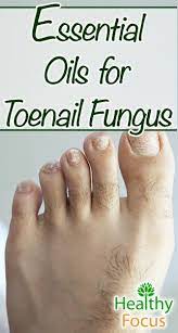 Essential Oils For Toenail Fungus Include Tea Tree Thyme Manuka Oregano Clove Cinnamon A Nail Fungus Essential Oils Toenail Fungus Essential Oils For Skin