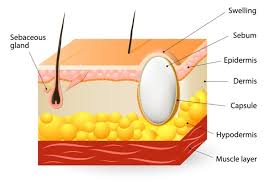 Image result for Cysta