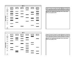 They need to be excited about learning about these molecules and. Gel Electrophoresis Worksheets Teaching Resources Tpt