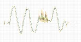 Kalman Filter Vs Complementary Filter