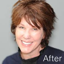 Grand Rapids Dentist Dr. Randall Chambers Satisfied Patients Before and  After