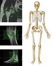 In skeletal animation, bones is the part of a skeletal system used to help control realistic movement of the model. Module 2 Lower Extremity Orthopedic Imaging