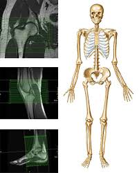 It is one of those organs of the body that has greater width than length besides prostate. Module 2 Lower Extremity Orthopedic Imaging