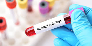 Your health is more important than anything else. New Tool Pulls Elusive Covid 19 Marker From Human Blood Lab Manager