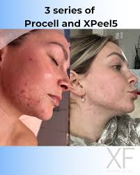 Julie Rose Grosso (@xfskincarebyjulie) • Instagram फोटोहरू र भिडियोहरू