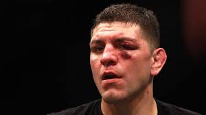 Nick Diaz's Possible UFC Return: New Information Revealed