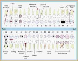 Dental Charting D O D Dental Assistant Study Dental