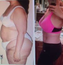 Maybe you would like to learn more about one of these? Skin Removal Surgery Orlando Celebrities Choice Cosmetic Surgery