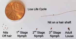 Image result for lice vs nits