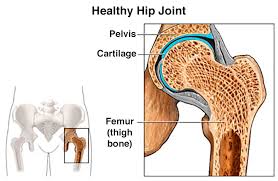Benjamin ma, md, professor, chief, sports medicine and shoulder service, ucsf department of orthopaedic surgery, san francisco, ca. Hip Pain Symptoms Treatments Conditions University Of Utah Health
