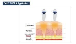 Image result for Hionanthera