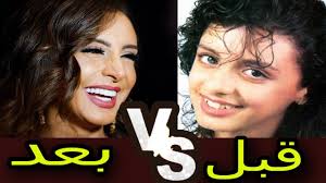 Angham mohamed ali suleiman ( arabic: Ø£Ø³Ù†Ø§Ù† Ø£Ù†ØºØ§Ù… Ù‚Ø¨Ù„ ÙˆØ¨Ø¹Ø¯ Ø£ÙƒØ¨Ø± Ù…ÙˆÙ‚Ø¹ Ù„Ø·Ø¨ Ø§Ù„Ø£Ø³Ù†Ø§Ù† ÙÙ‰ Ø§Ù„ÙˆØ·Ù† Ø§Ù„Ø¹Ø±Ø¨Ù‰