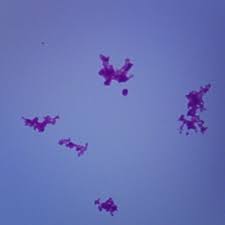 Image result for Corynebacterium