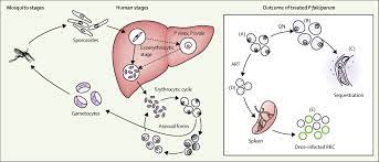 Falciparum, if not promptly and correctly treated. Malaria The Lancet