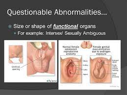 Intersex Anatomy Photos Anatomy Drawing Diagram