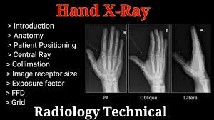 Image result for Hand XRay
