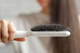 Hair loss after hair transplantation. Post Surgical Hair Loss Terra Medical Clinic Singapore