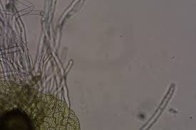 Image result for Parkeriaceae